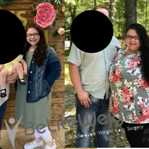 Weight Loss Surgery Before And After Stephanie K - 2 Year Update*